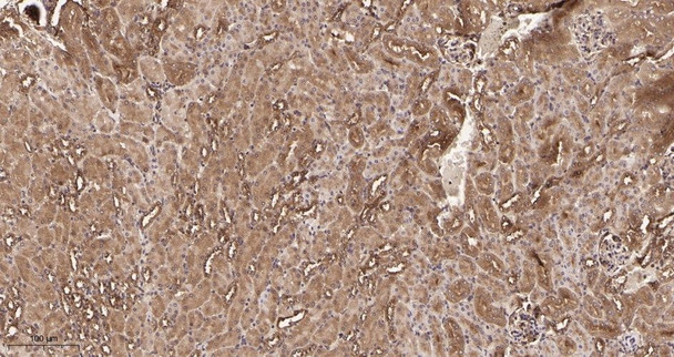 Recombinant Rab 5A Monoclonal Antibody (AGEL5940)