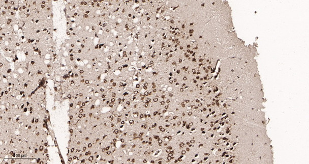Recombinant YTHDF1 Monoclonal Antibody (AGEL5944)