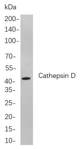 Recombinant Cathepsin D Monoclonal Antibody (AGEL5953)