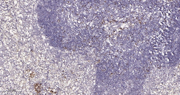 Recombinant FOXP3 Monoclonal Antibody (AGEL5958)