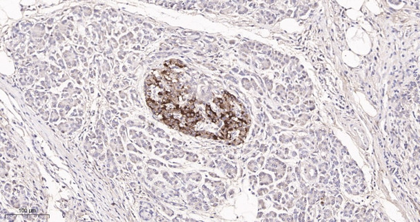 Recombinant PTEN Monoclonal Antibody (AGEL5961)