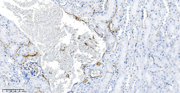 Recombinant LAMP2 Monoclonal Antibody (AGEL5963)
