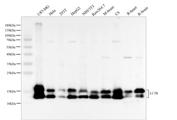 Recombinant LC3B Monoclonal Antibody (AGEL5968)