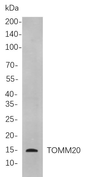 Recombinant TOMM20 Monoclonal Antibody (AGEL5973)