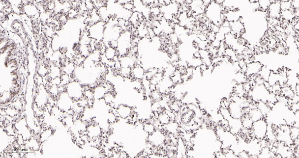 Recombinant ATF-4 Monoclonal Antibody (AGEL5974)