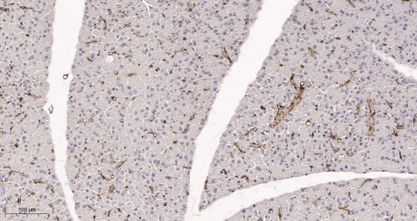 Recombinant FABP4 Monoclonal Antibody (AGEL5980)