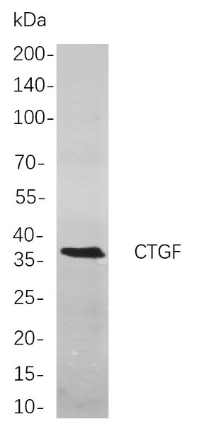 Recombinant CTGF Monoclonal Antibody (AGEL5981)