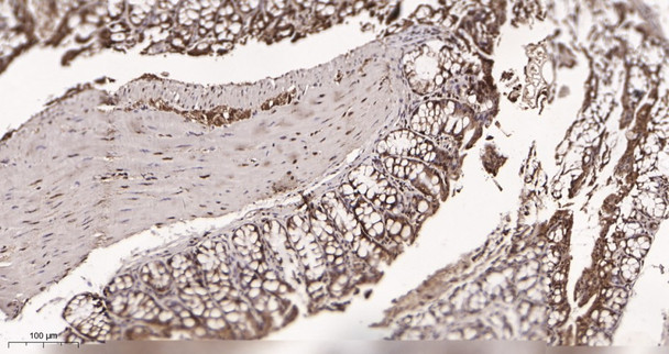 Recombinant TATA Box Binding Protein Monoclonal Antibody (AGEL5984)