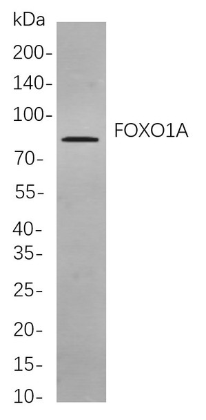 Recombinant FOXO1A Monoclonal Antibody (AGEL5987)