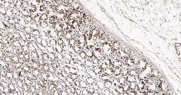 Recombinant UQCRC2 Monoclonal Antibody (AGEL5996)