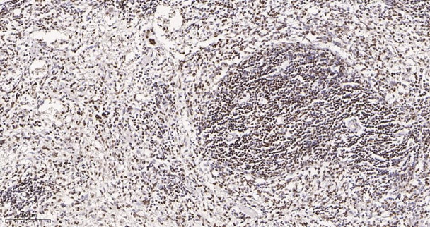Recombinant HDAC2 Monoclonal Antibody (AGEL6012)