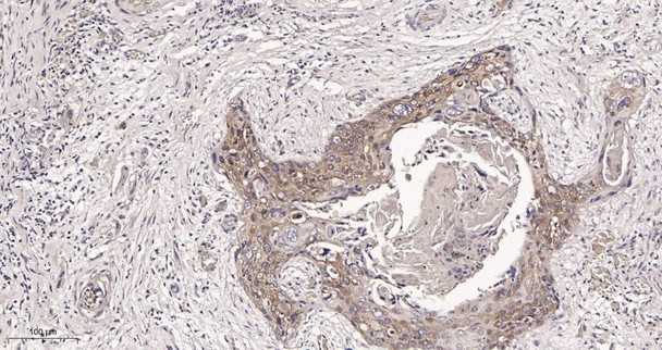Recombinant RIP Monoclonal Antibody (AGEL6019)