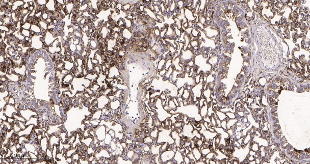 Recombinant PKM Monoclonal Antibody (AGEL6030)