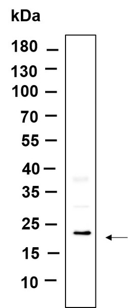 Recombinant TXD12 Monoclonal Antibody (AGEL6051)
