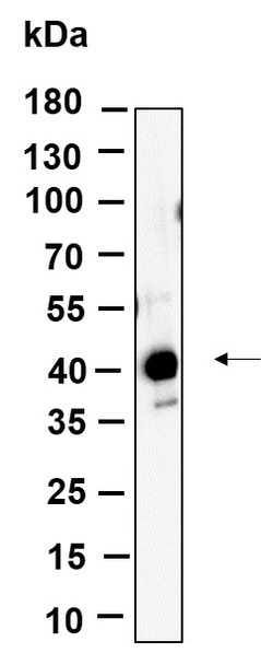 Recombinant FBX32 Monoclonal Antibody (AGEL6055)