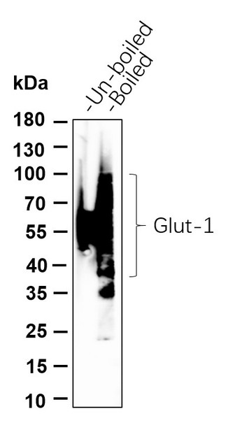 Recombinant Glut1 Monoclonal Antibody (AGEL6056)