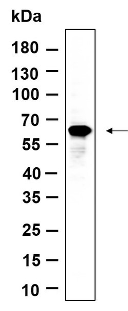 Recombinant FoxO4 Monoclonal Antibody (AGEL6073)