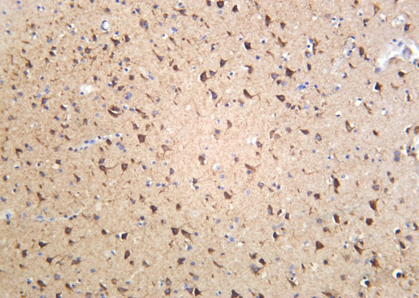 Recombinant Sortilin Monoclonal Antibody (AGEL6096)