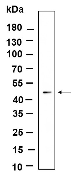 Recombinant ILK Monoclonal Antibody (AGEL6101)