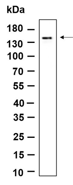 Recombinant MDA5 Monoclonal Antibody (AGEL6116)