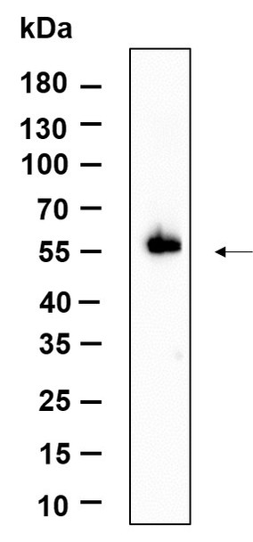 Recombinant STK3 Monoclonal Antibody (AGEL6119)