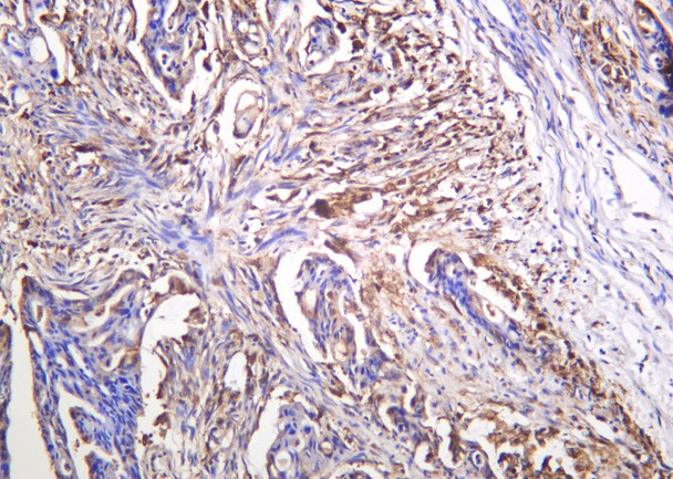 Recombinant Galectin-3 Monoclonal Antibody (AGEL6120)