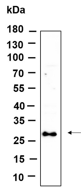 Recombinant SYPL1 Monoclonal Antibody (AGEL6139)