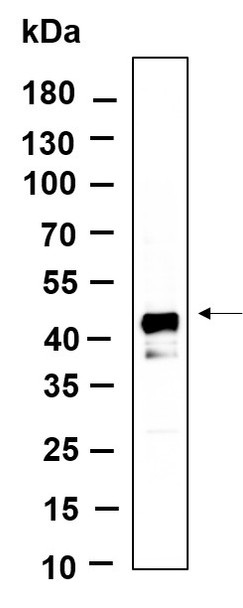 Recombinant DNAJA4 Monoclonal Antibody (AGEL6147)