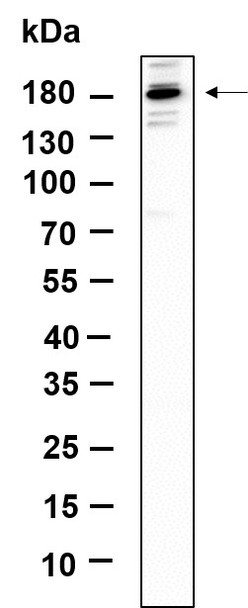 Recombinant TIAM2 Monoclonal Antibody (AGEL6152)