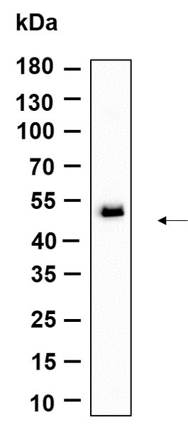 Recombinant TMEM43 Monoclonal Antibody (AGEL6160)