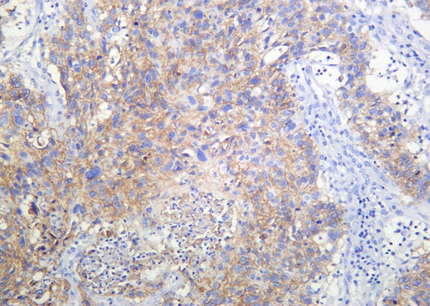 Recombinant RSK3 Monoclonal Antibody (AGEL6174)
