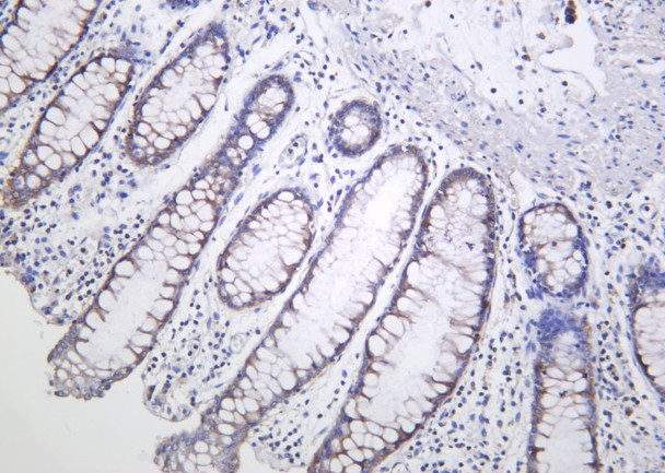 Recombinant AMPKβ1 Monoclonal Antibody (AGEL6188)