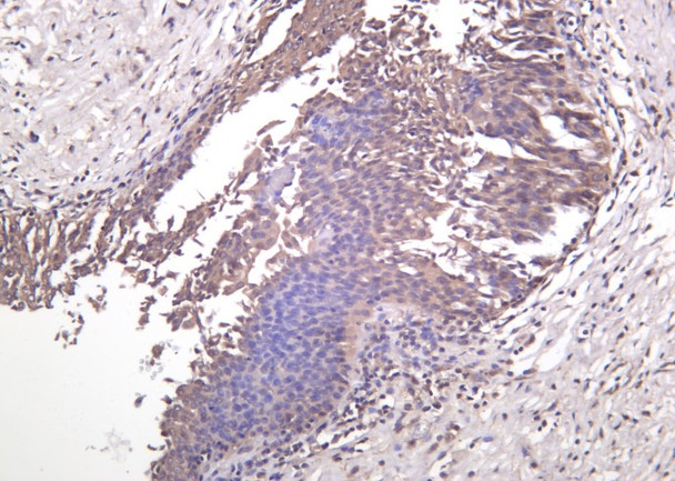 Recombinant MEK-7 Monoclonal Antibody (AGEL6195)