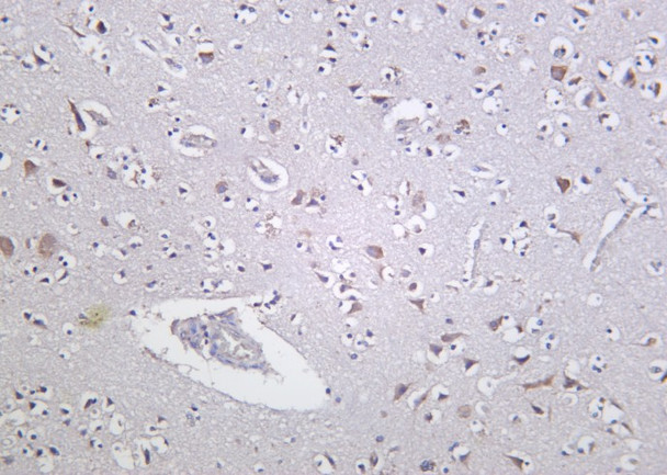 Recombinant PKD1 Monoclonal Antibody (AGEL6200)