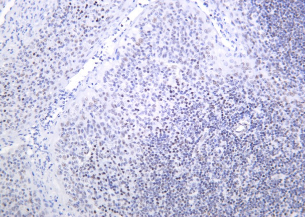 Recombinant Bmi-1 Monoclonal Antibody (AGEL6202)