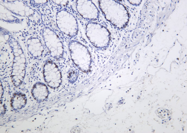 Recombinant MCM2 Monoclonal Antibody (AGEL6203)
