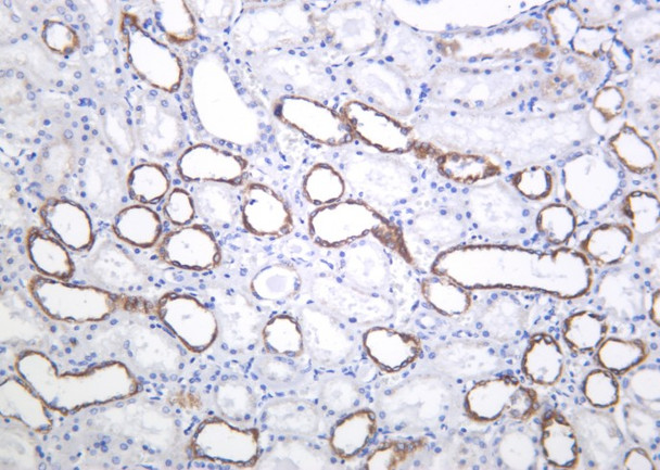 Recombinant PAI-1 Monoclonal Antibody (AGEL6213)