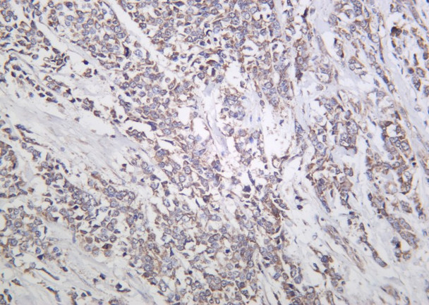Recombinant Actinin-α1 Monoclonal Antibody (AGEL6221)