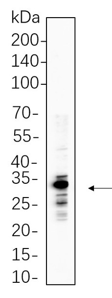 Recombinant ELNE Monoclonal Antibody (AGEL6225)