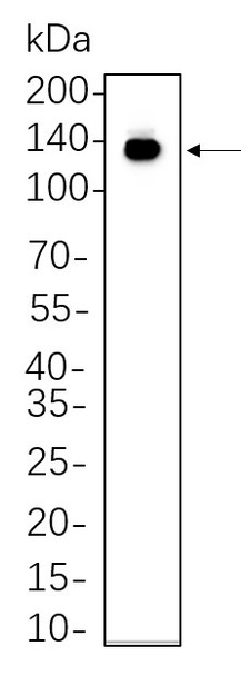 Recombinant CD117/c-Kit Monoclonal Antibody (AGEL6232)