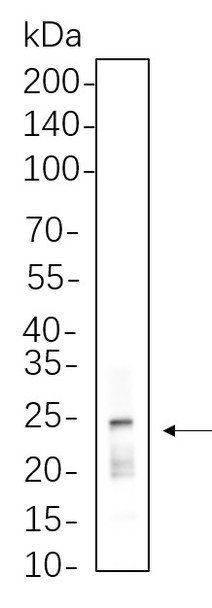 Recombinant Rab11 Monoclonal Antibody (AGEL6241)