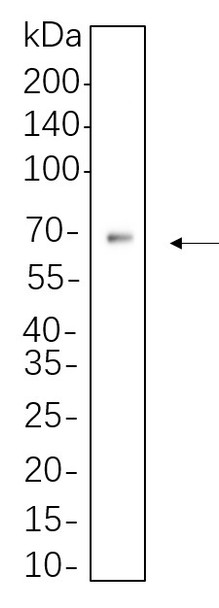 Recombinant AFP Monoclonal Antibody (AGEL6247)