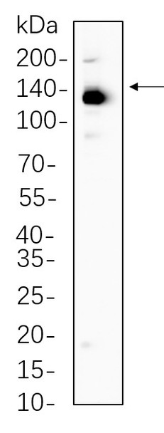 Recombinant ULK1 Monoclonal Antibody (AGEL6249)
