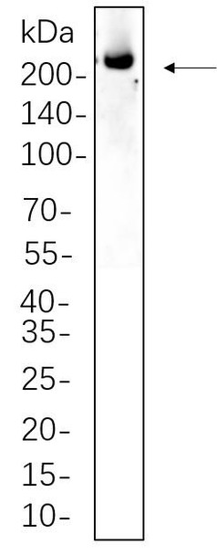 Recombinant ALK Monoclonal Antibody (AGEL6287)