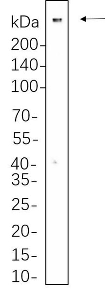 Recombinant 53BP1 Monoclonal Antibody (AGEL6298)