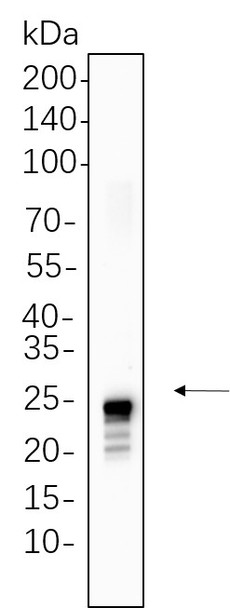 Recombinant TAGLN Monoclonal Antibody (AGEL6299)