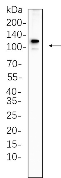 Recombinant PMS2 Monoclonal Antibody (AGEL6308)