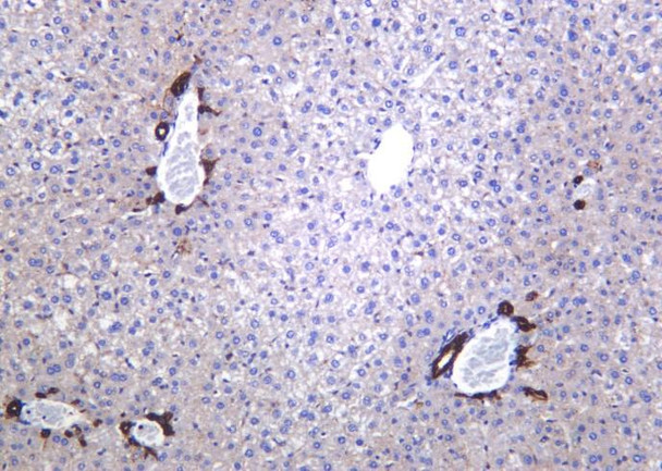 Recombinant LDLR Monoclonal Antibody (AGEL6331)