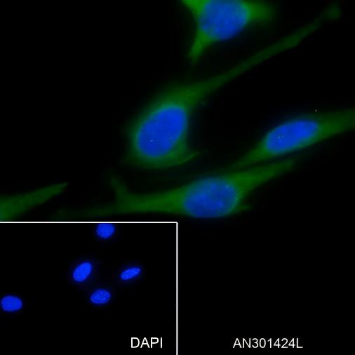 Recombinant ABCE1 Monoclonal Antibody (AGEL6353)
