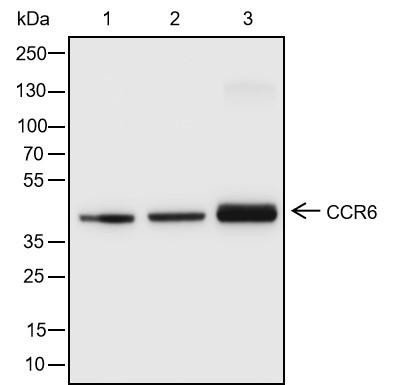 Recombinant CCR6 Monoclonal Antibody (AGEL6388)